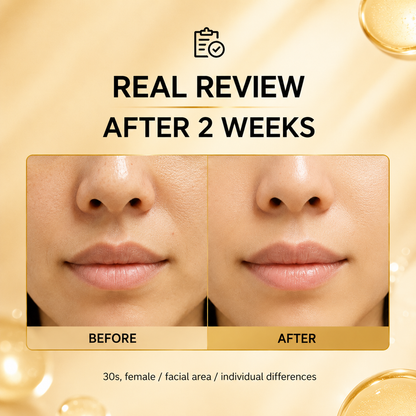 Kojic Acid Niacinamide Whitening Serum Dark Spot Remover Brightening Cream Freckle Mask Fade Acne Scars Melasma Dull Skin