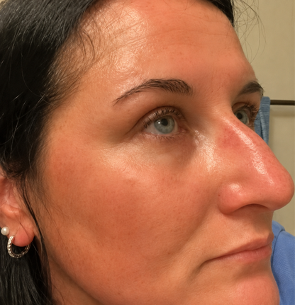Kojic Acid Niacinamide Whitening Serum Dark Spot Remover Brightening Cream Freckle Mask Fade Acne Scars Melasma Dull Skin