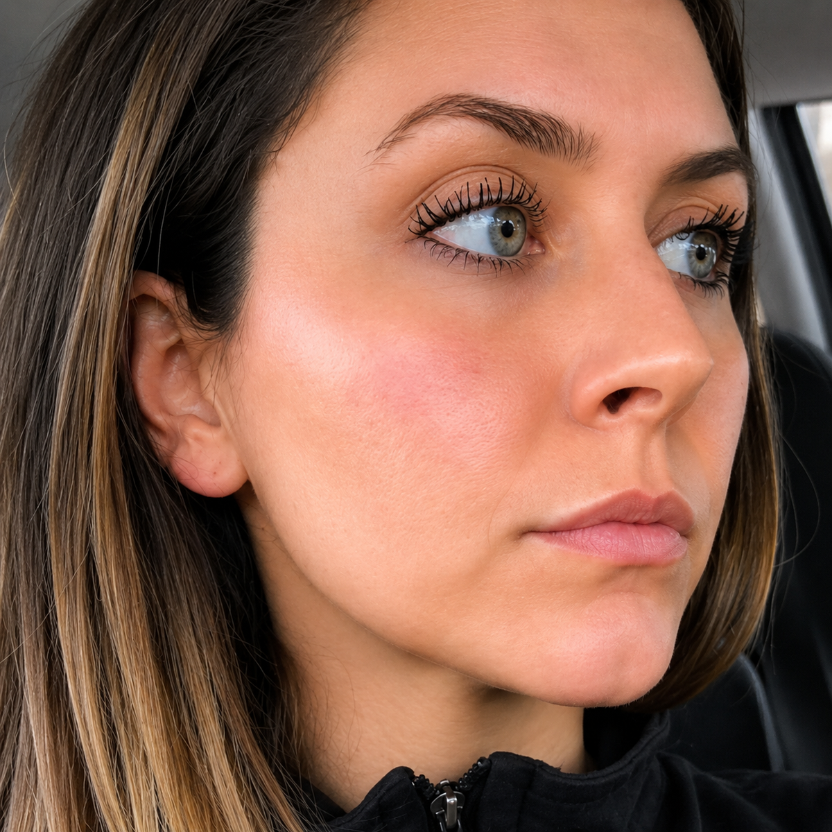 Kojic Acid Niacinamide Whitening Serum Dark Spot Remover Brightening Cream Freckle Mask Fade Acne Scars Melasma Dull Skin