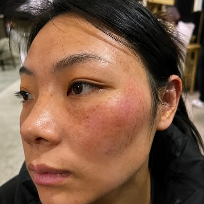 Kojic Acid Niacinamide Whitening Serum Dark Spot Remover Brightening Cream Freckle Mask Fade Acne Scars Melasma Dull Skin