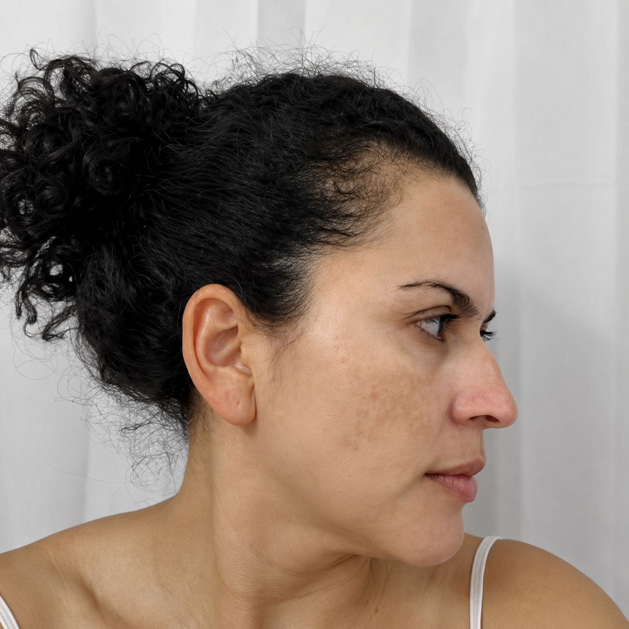Kojic Acid Niacinamide Whitening Serum Dark Spot Remover Brightening Cream Freckle Mask Fade Acne Scars Melasma Dull Skin